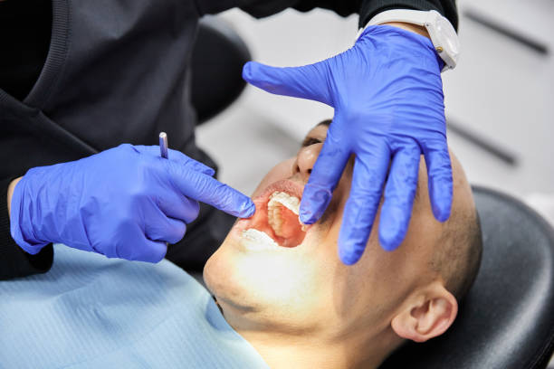 Best Emergency Treatment for Dental Infections or Abscesses in Plains, MT